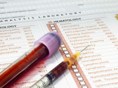 El colesterol bueno y sus incógnitas El colesterol bueno